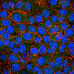 MilliporeSigma Rabbit anti-ICAT, Polyclonal, 100&mu;g:Antibodies, Polyclonal
